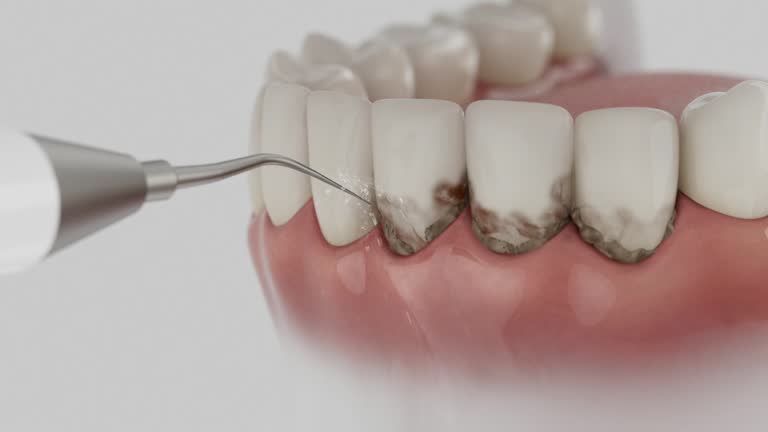 Reliable Dental contractor in Ansonia, OH by Dentist Open Now